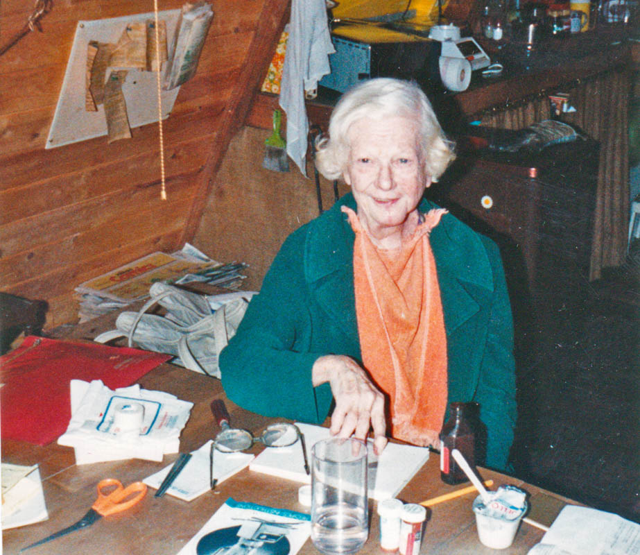 lorna post surgery 1991