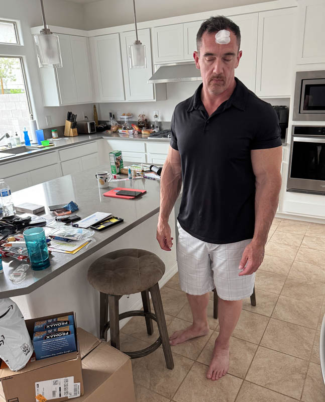 noah basal cell removal